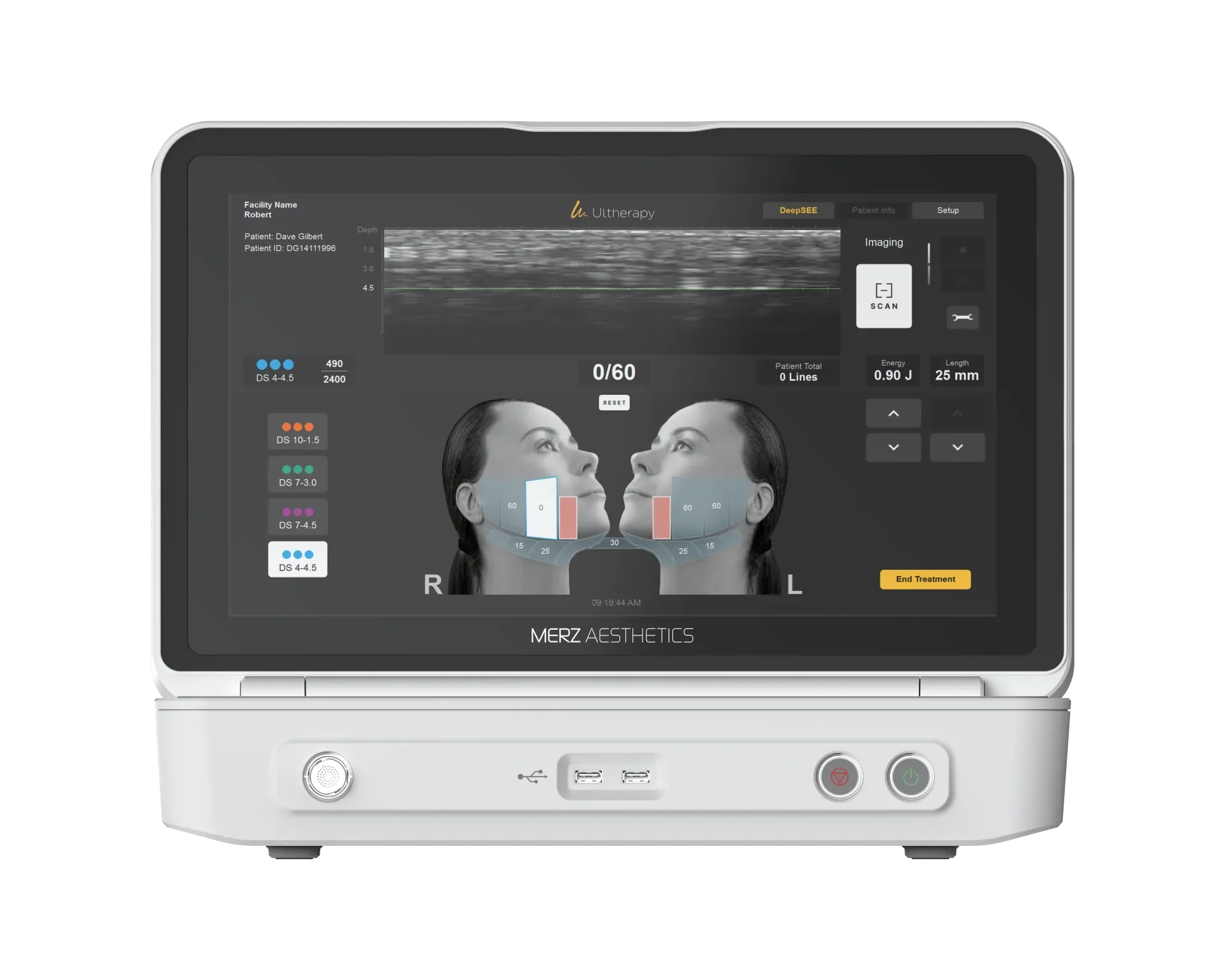Incheon Airport Ultherapy — device imagery